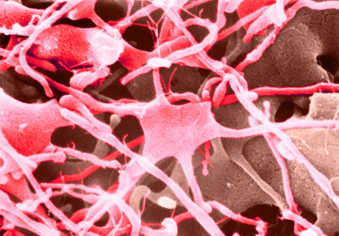 Uso De Células-Tronco Em Recém-Nascidos Com Fluxo Sanguíneo Insuficiente Para O Cérebro