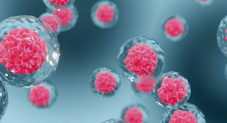 Quais doenças já são tratadas com células-tronco mesenquimais?